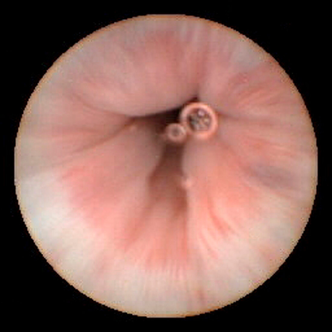 Healthy oesophagus,pill camera view