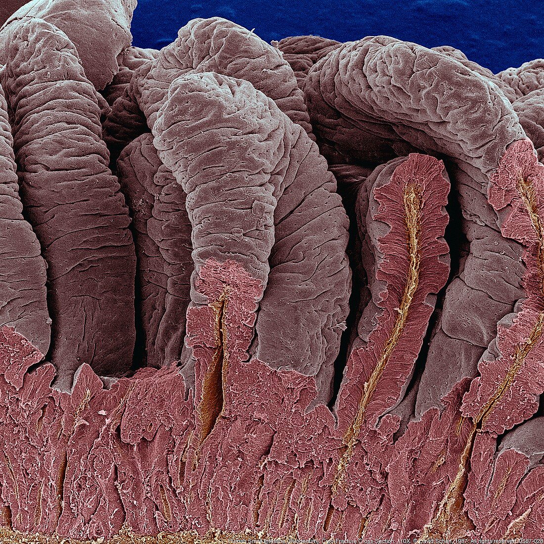 False-colour SEM of intestinal villi