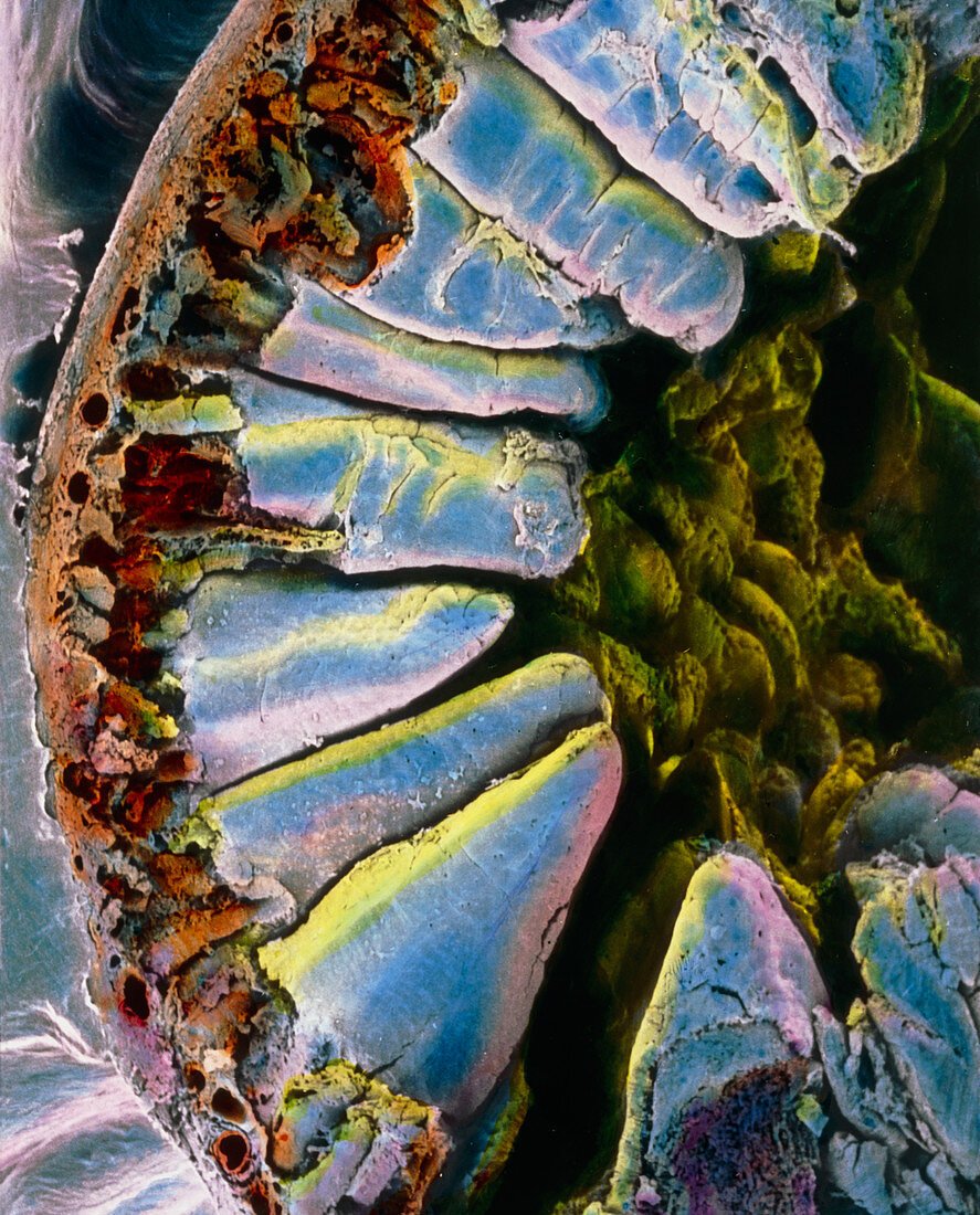 SEM through the wall of the duodenum