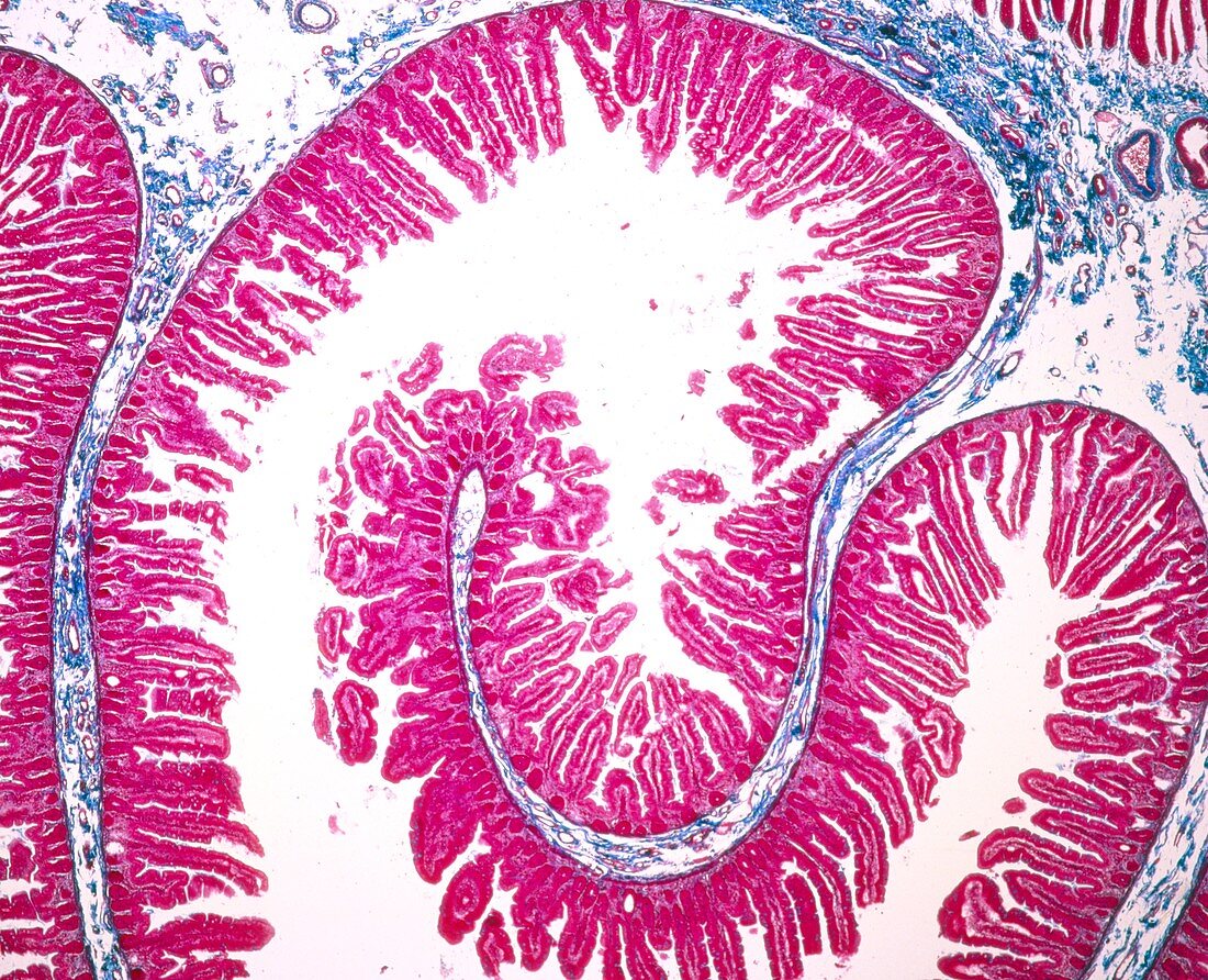 Light micrograph of small intestine - jejunum