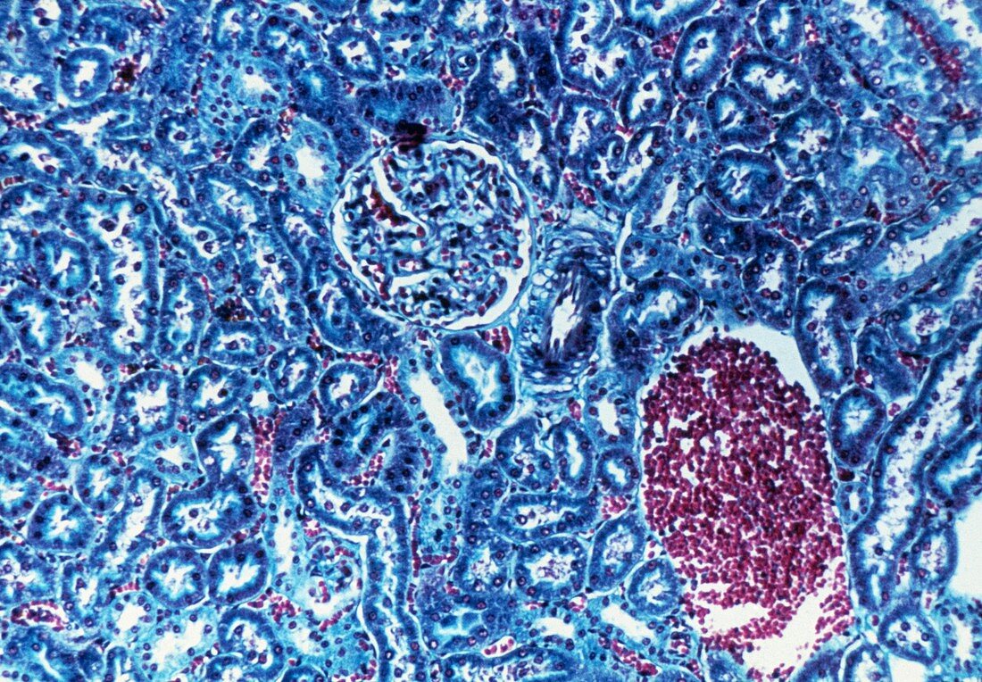 LM of glomerulus and tubules in a kidney section