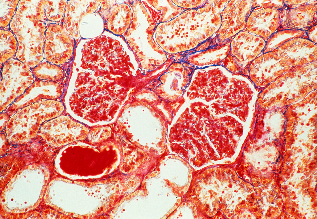 LM of glomerulus and tubules in a kidney section