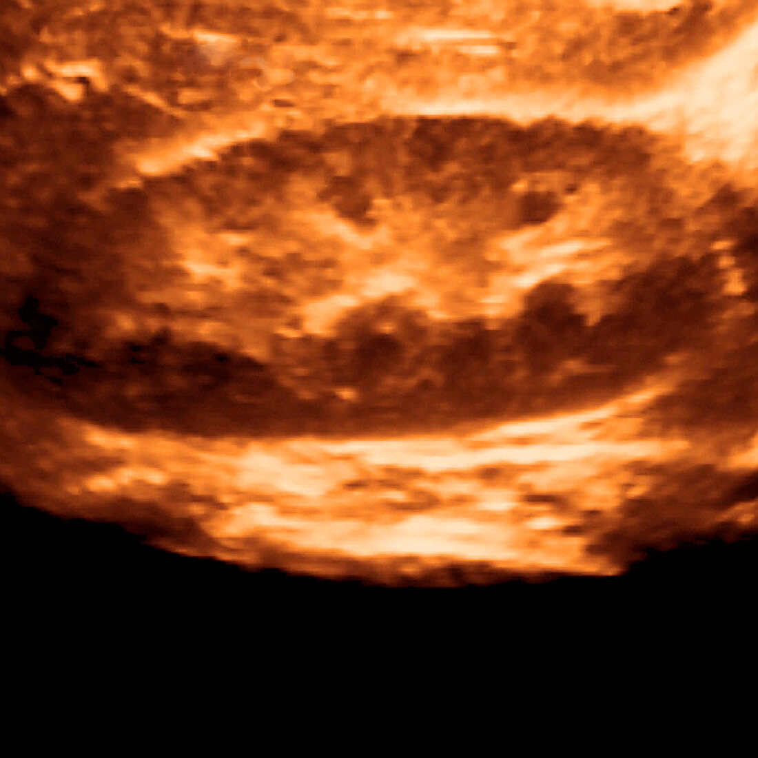 Kidney,ultrasound scan