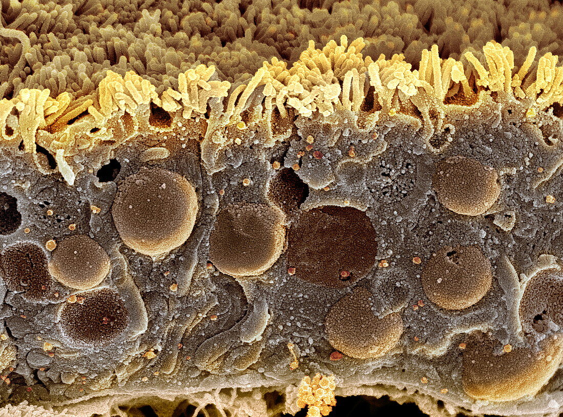 Kidney tubule,SEM