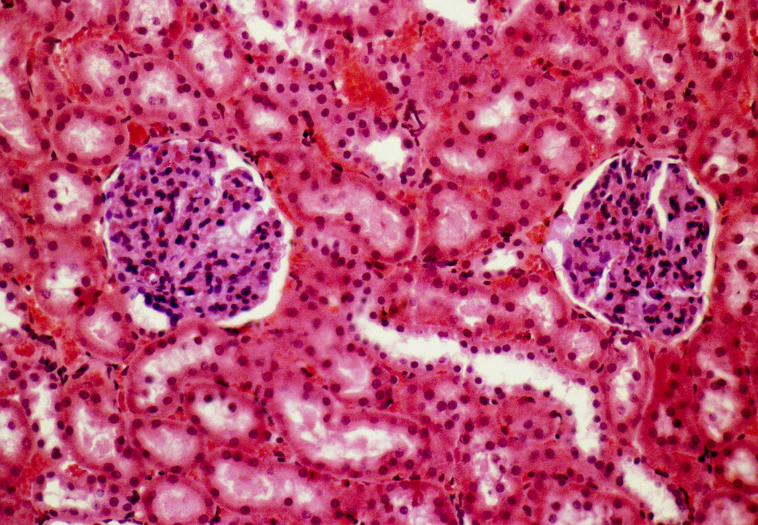 Kidney glomeruli,light micrograph