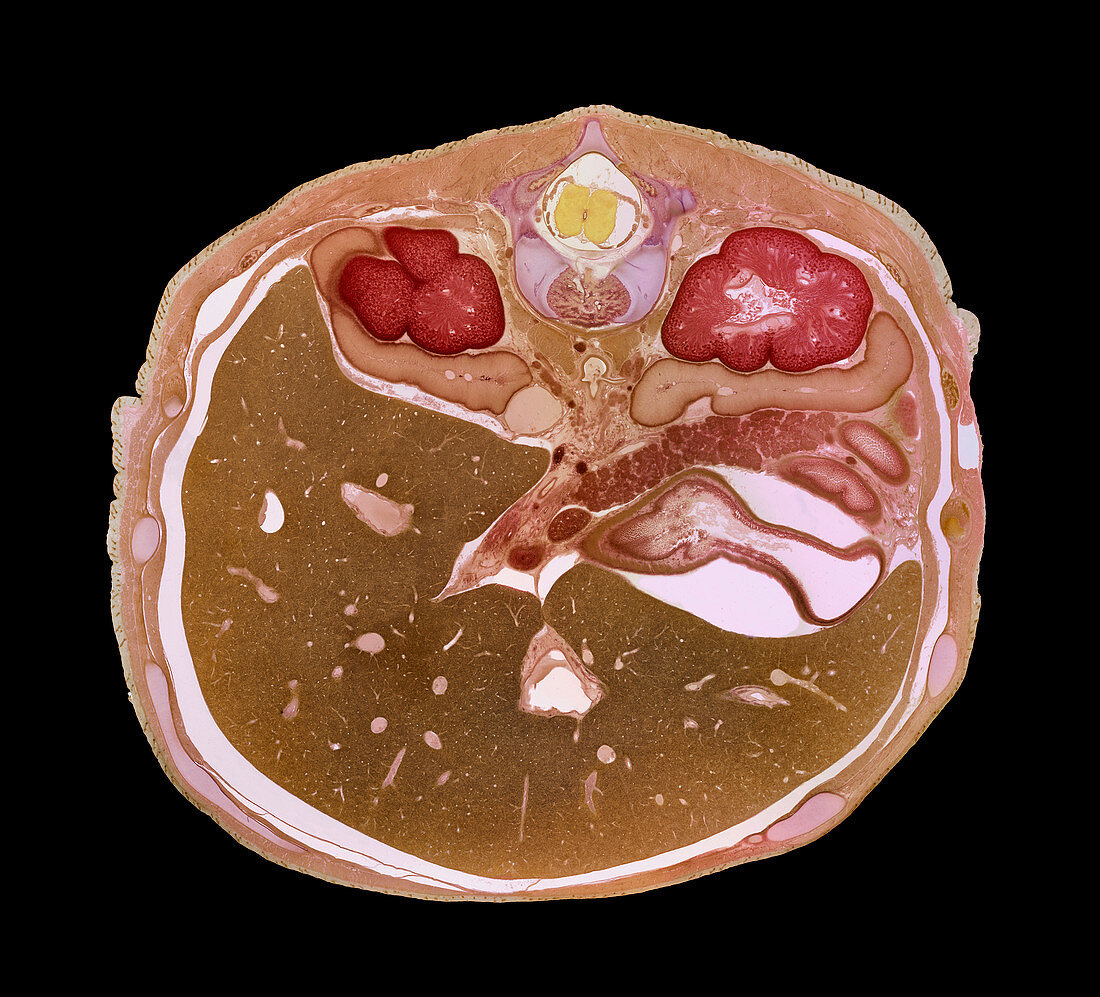 Foetal liver,light micrograph