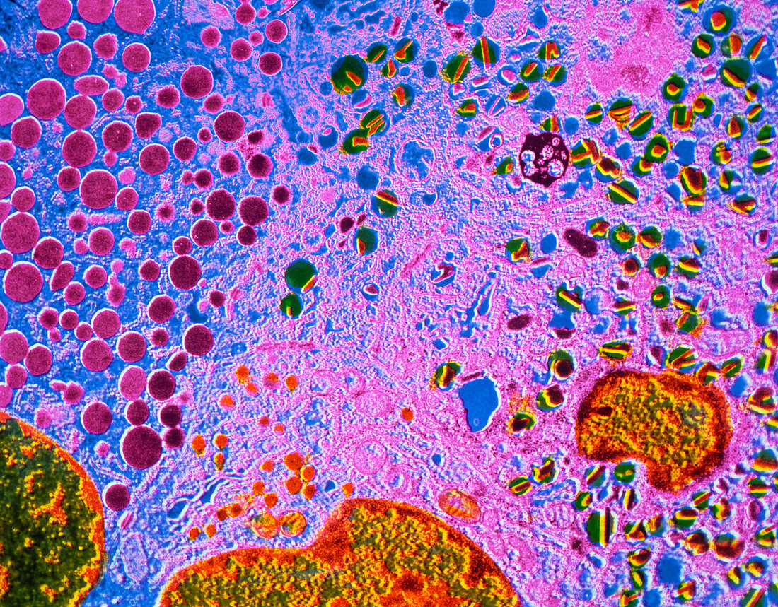 False-colour TEM showing cells of Langerhans