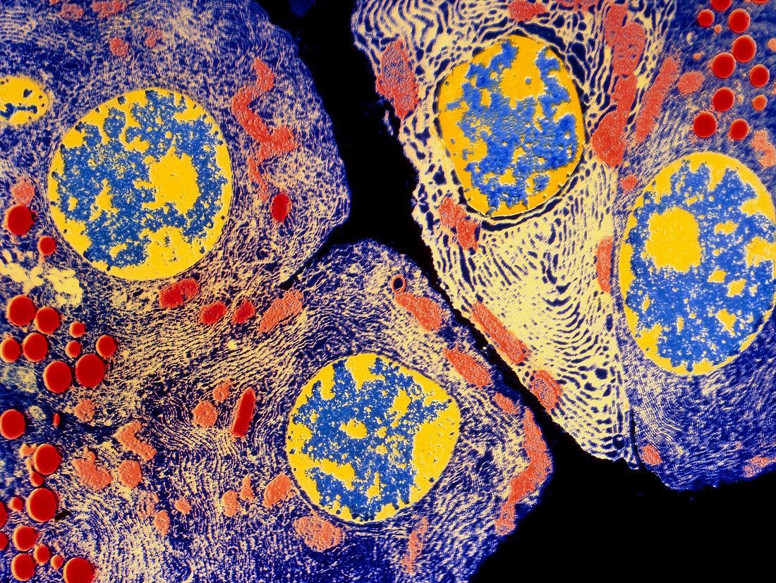 Coloured TEM of pancreatic acinar secretory cells