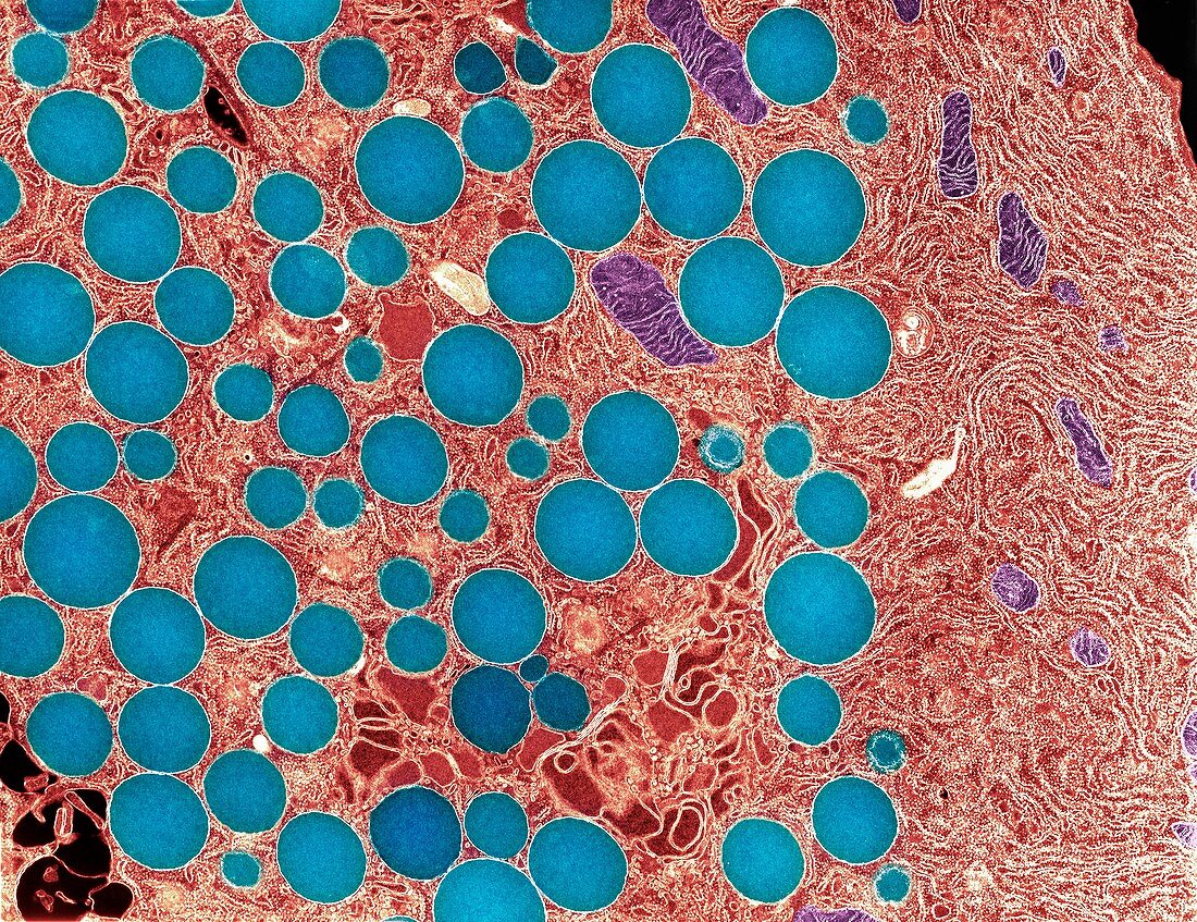 Pancreatic secretory cell,TEM