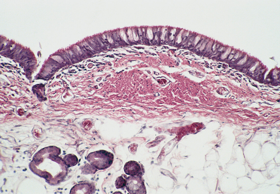 LM of a longitudinal section of the trachea