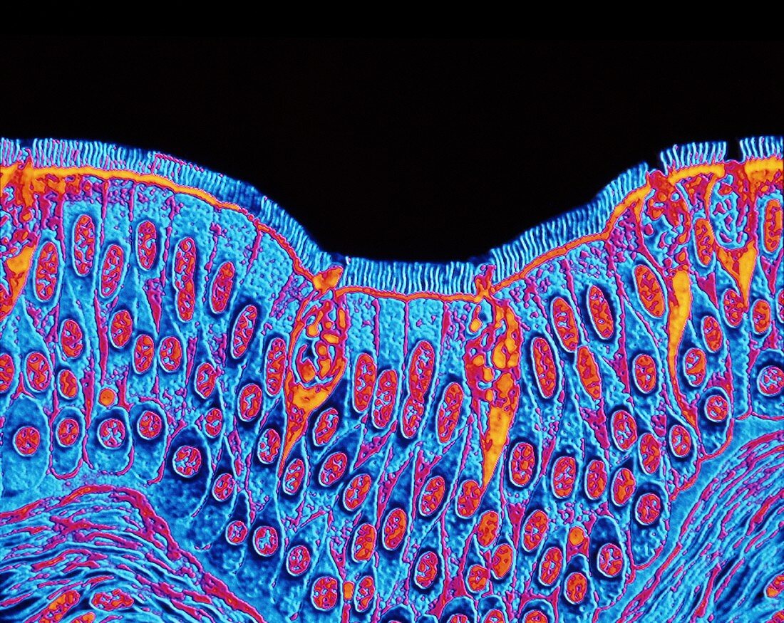 Coloured LM of human tracheal epithelium