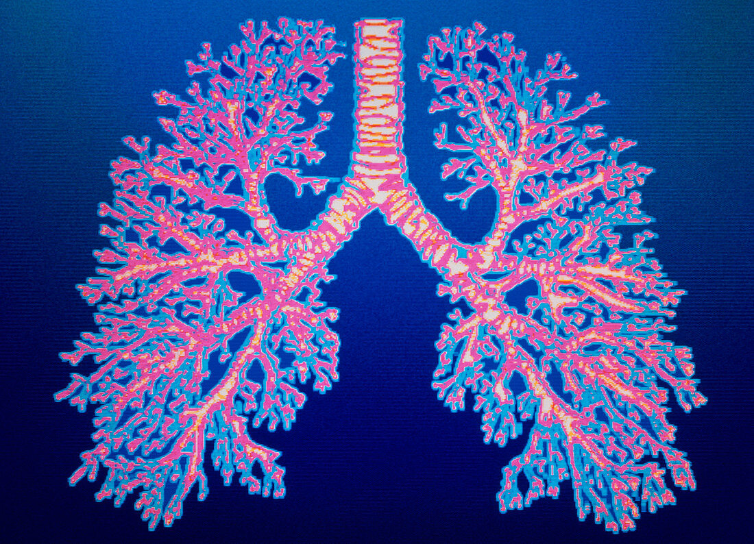 Bronchial tree of lungs