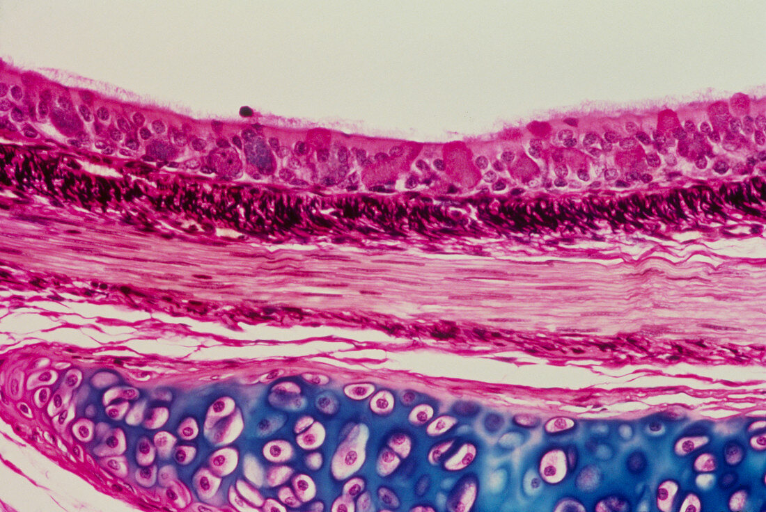LM of a section through a bronchus of the lung