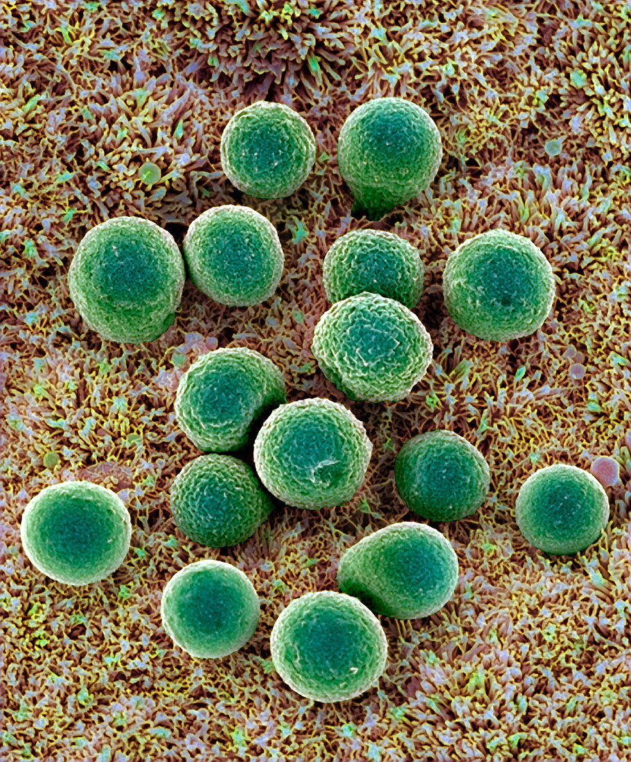 Mucus droplets,SEM