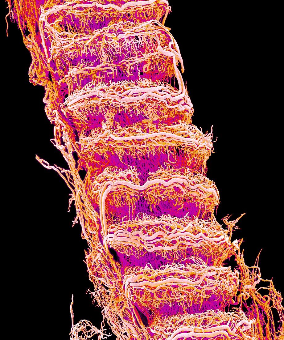 Trachea blood vessels,SEM