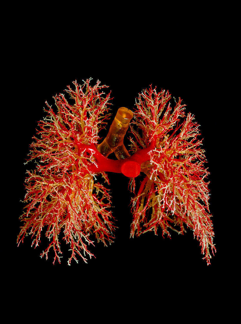 Resin cast of the airways & arterie of the lungs