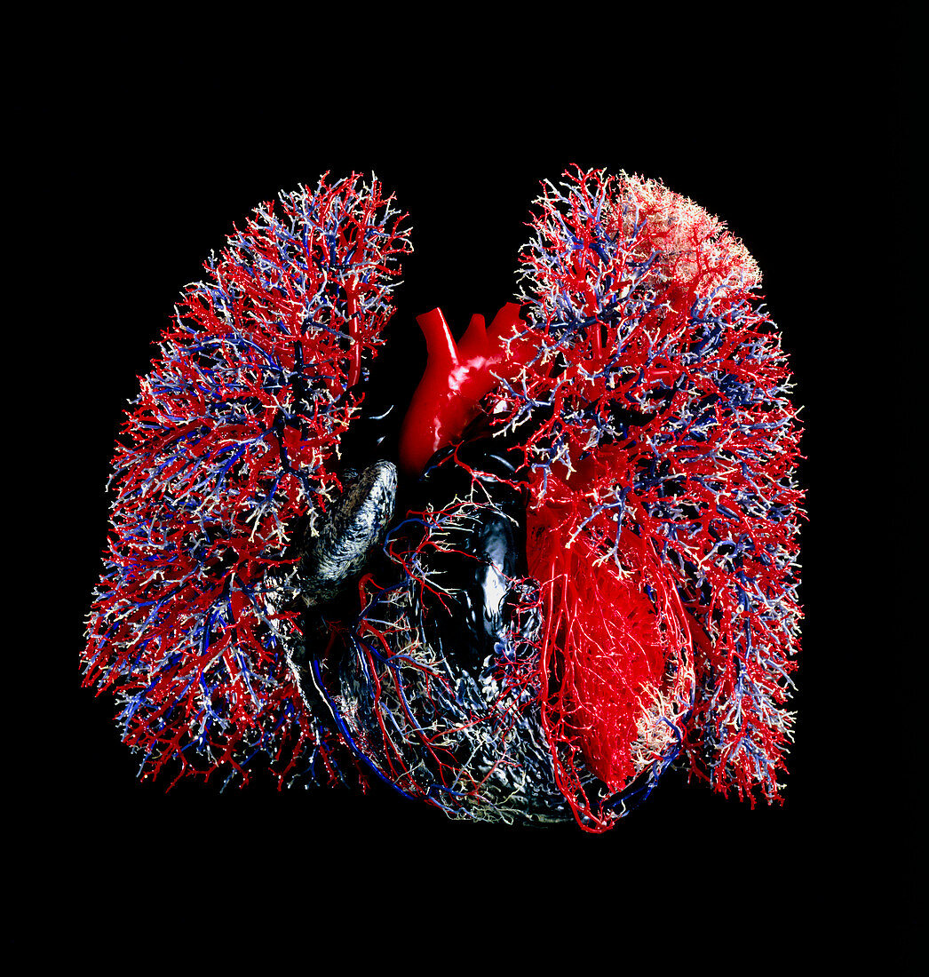 Resin cast of the blood vessels of heart & lungs