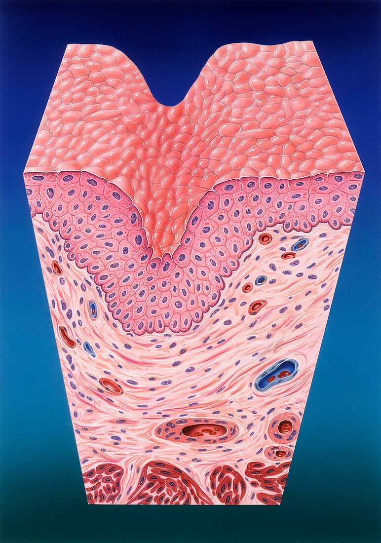 Urinary bladder wall,artwork