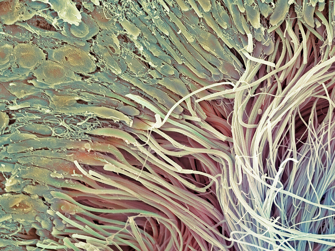 Sperm in seminiferous tubule,SEM