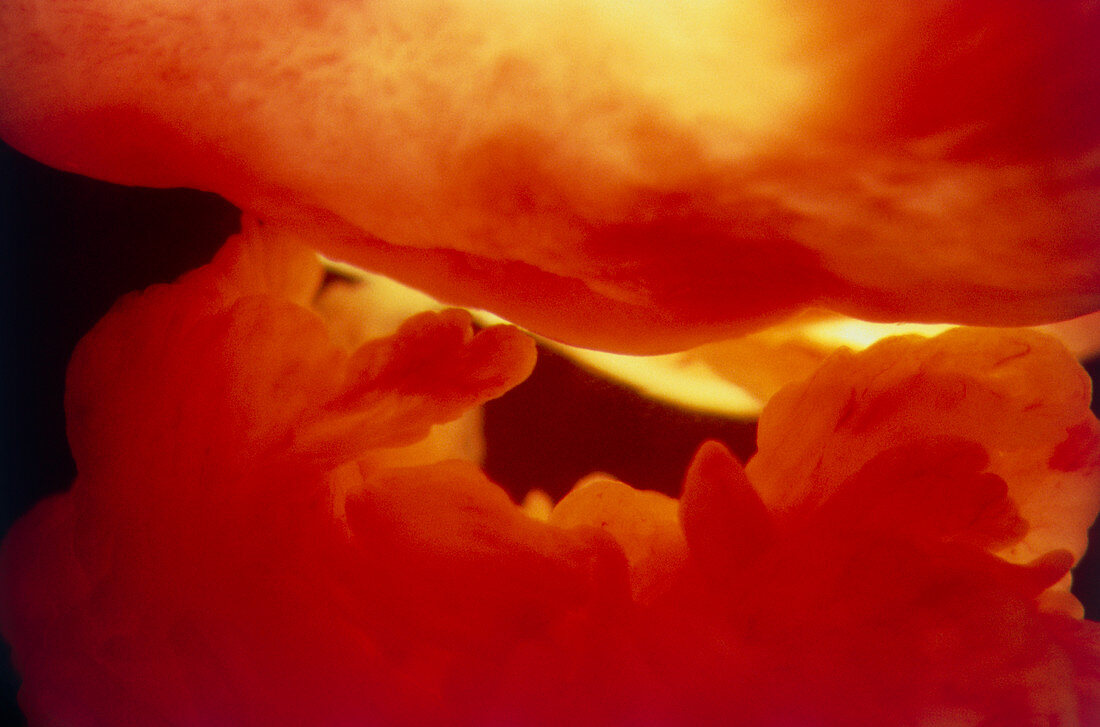 Endoscope image of human ovary & fallopian tube