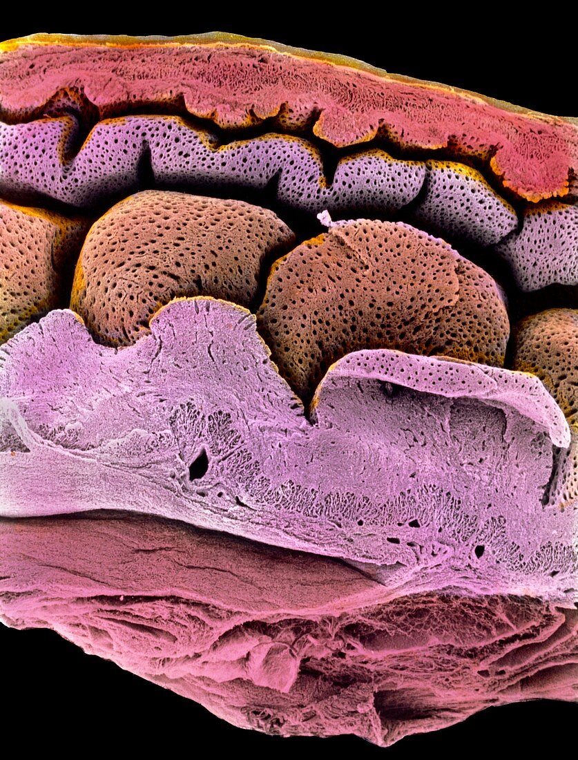 Coloured SEM of the uterus-oviduct junction