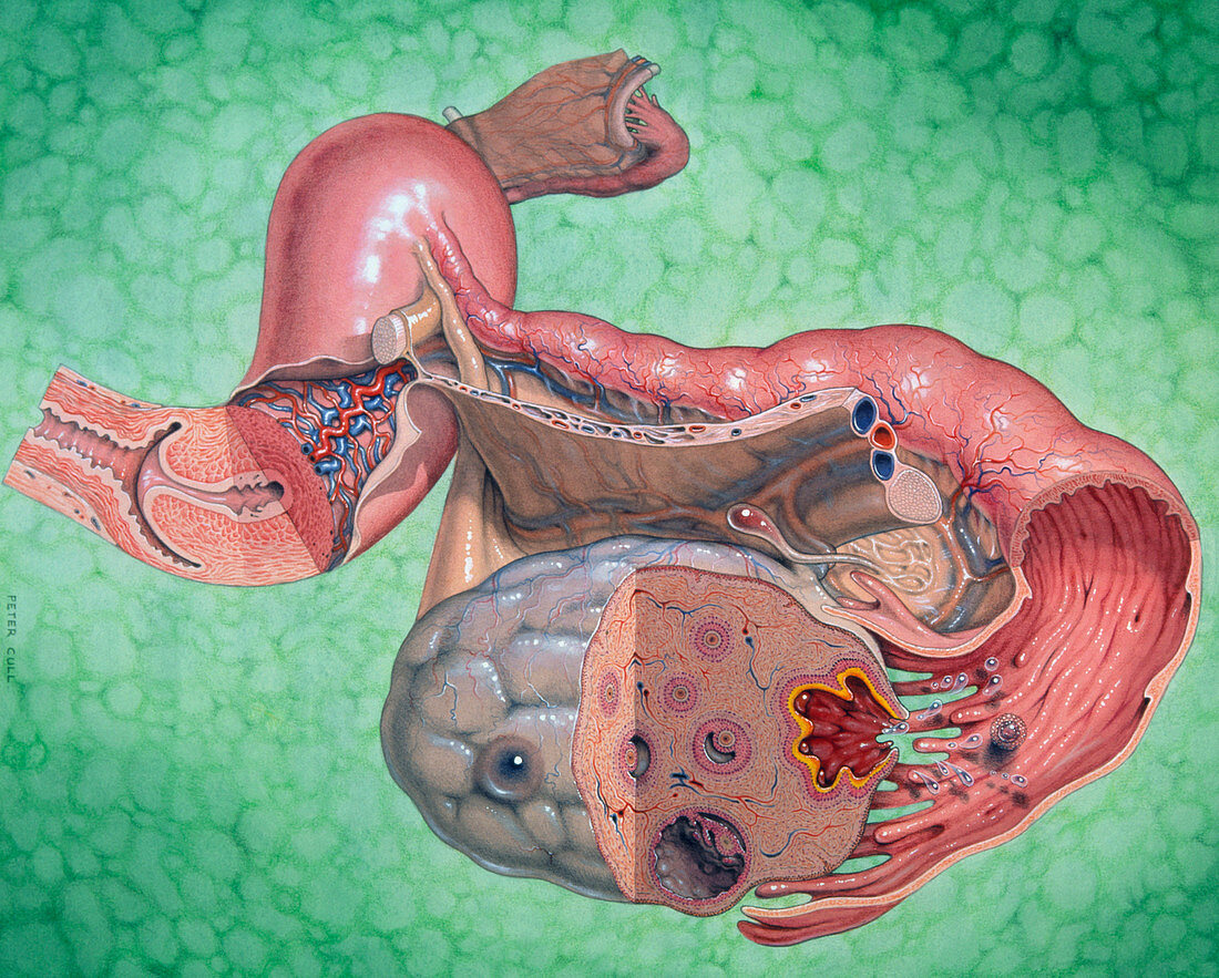 Artwork of human reproductive system; ovulation