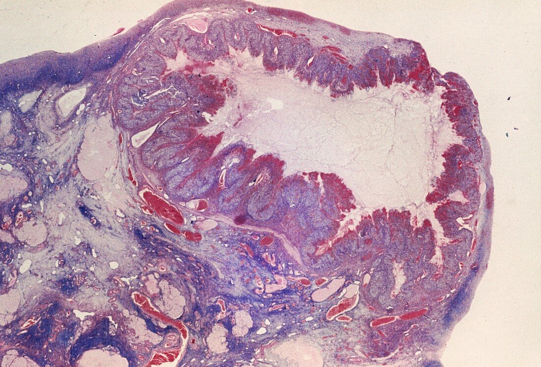 LM of a section through corpus luteum of the ovary