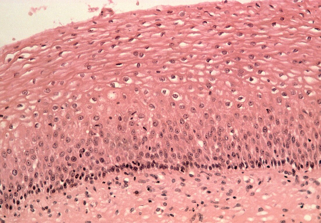 LM of a section through healthy cervix epithelium