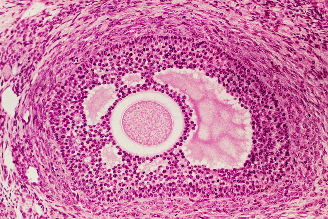 LM of section through a Graafian follicle in ovary