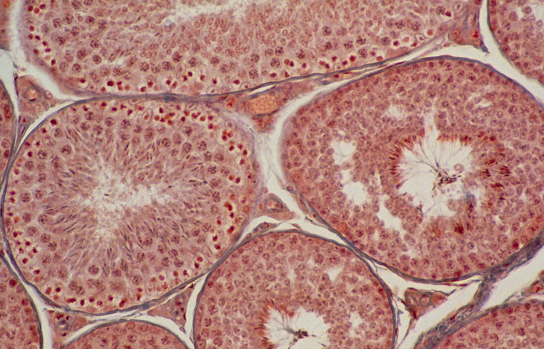 LM of seminiferous tubules in a human testicle