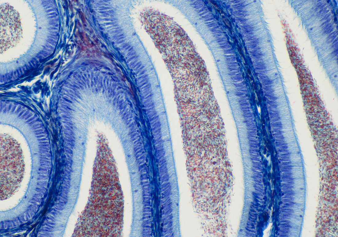Light micrograph of normal human epididymis