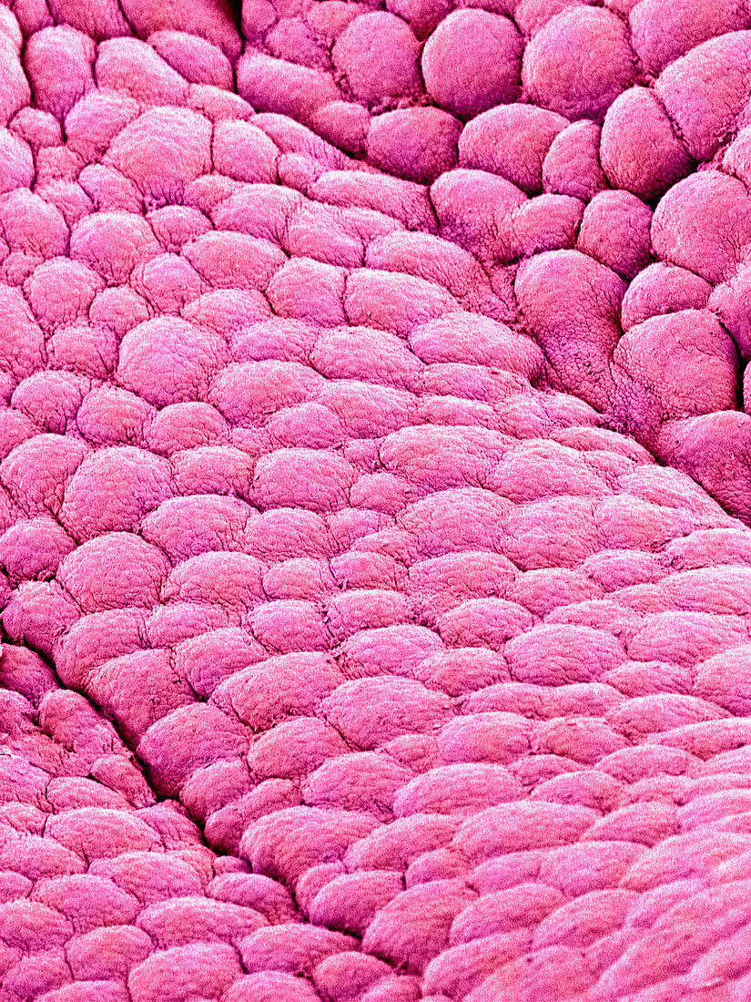 Internal wall of uterus,SEM