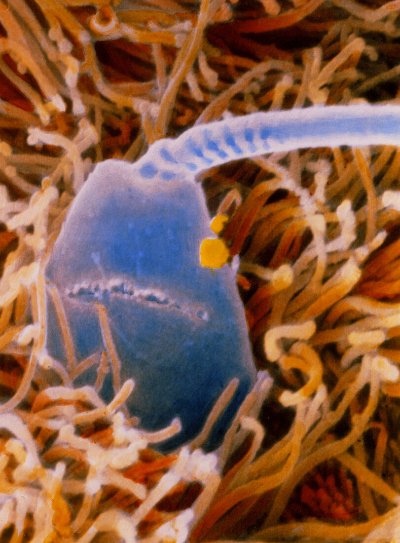 F. colour SEM of sperm being capacitated in uterus