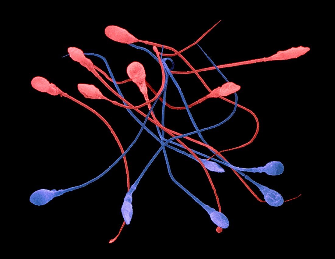 Coloured SEM of human sperm: male & female types