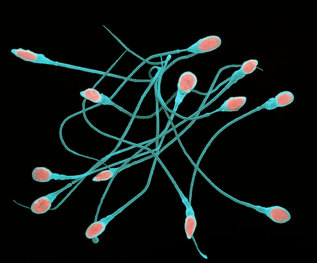 Coloured SEM of human sperm