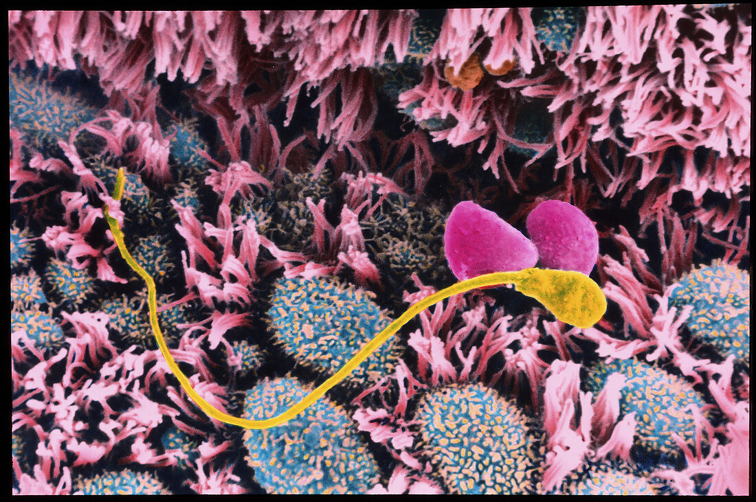 Coloured SEM of a sperm in a fallopian tube