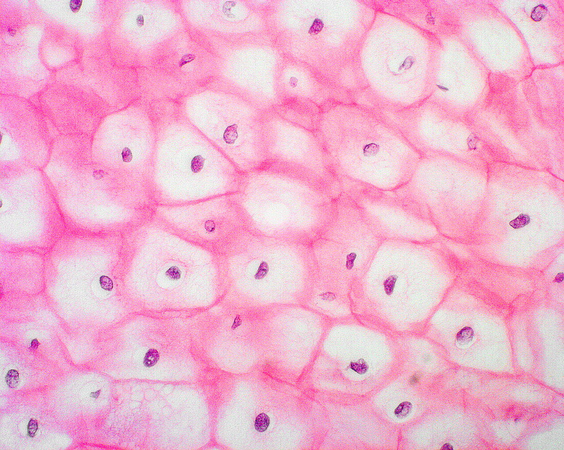 Cervical cells,light micrograph
