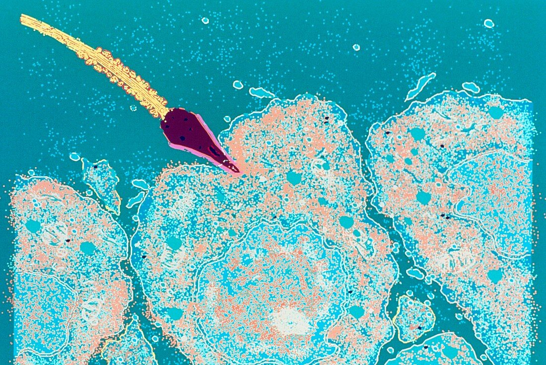 False-colour TEM of a human sperm penetrating ovum