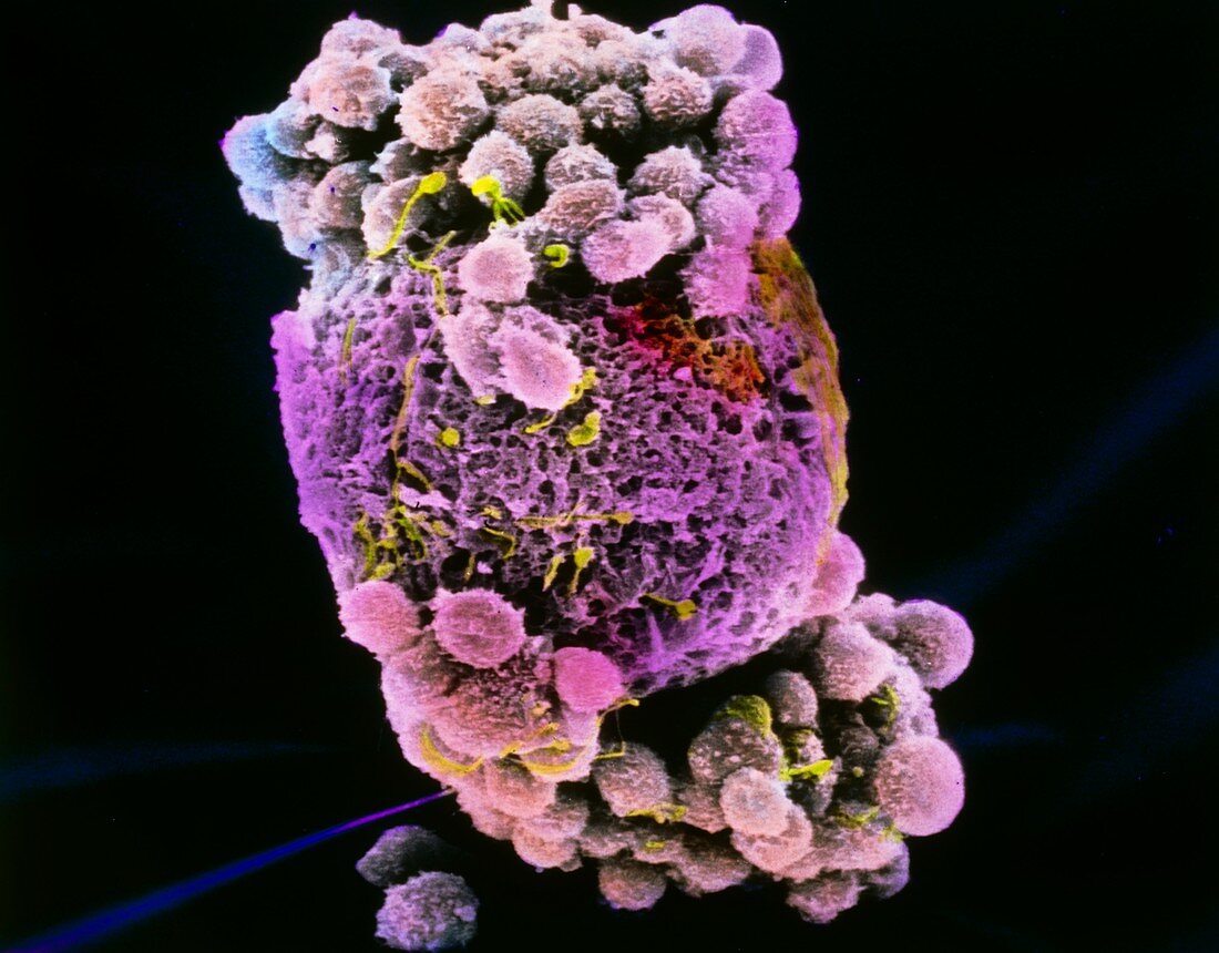 Coloured SEM of a human egg fertilised by sperm