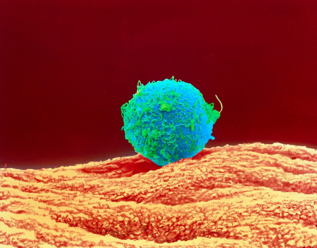 Coloured SEM of sperm on egg during fertilisation