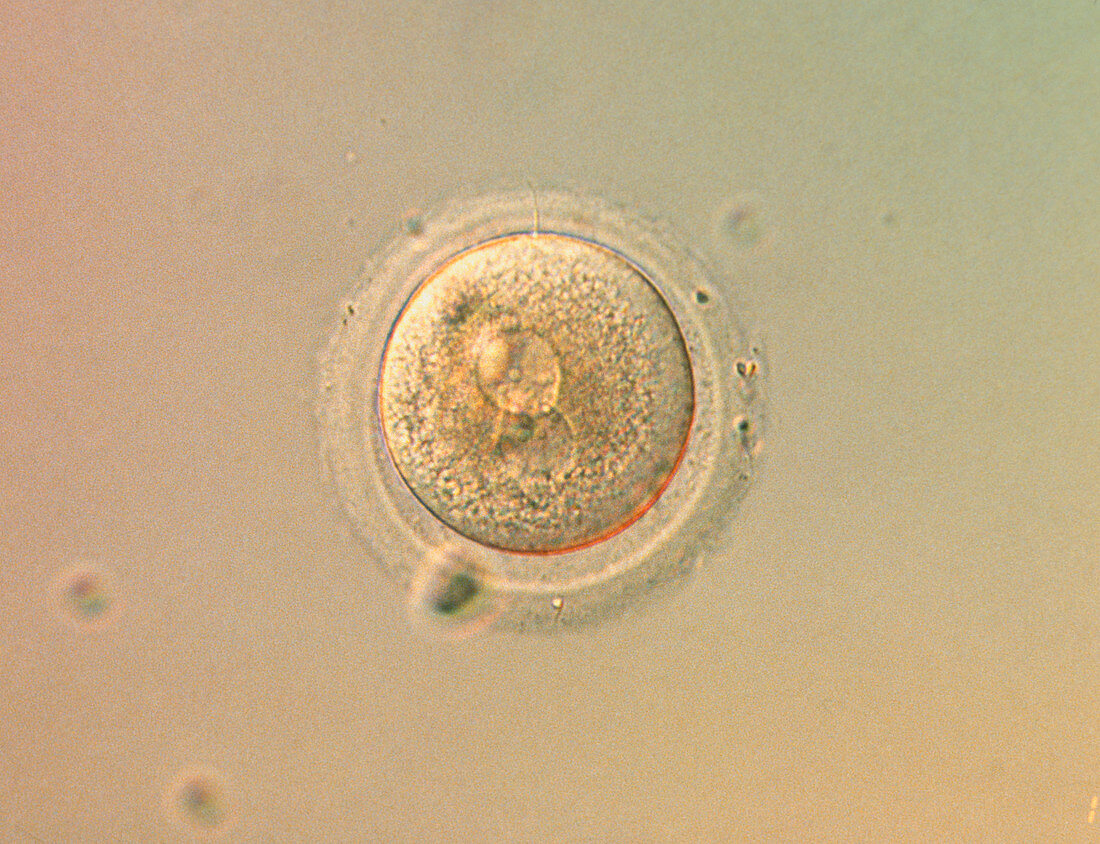 LM of human zygote during in-vitro fertilisation