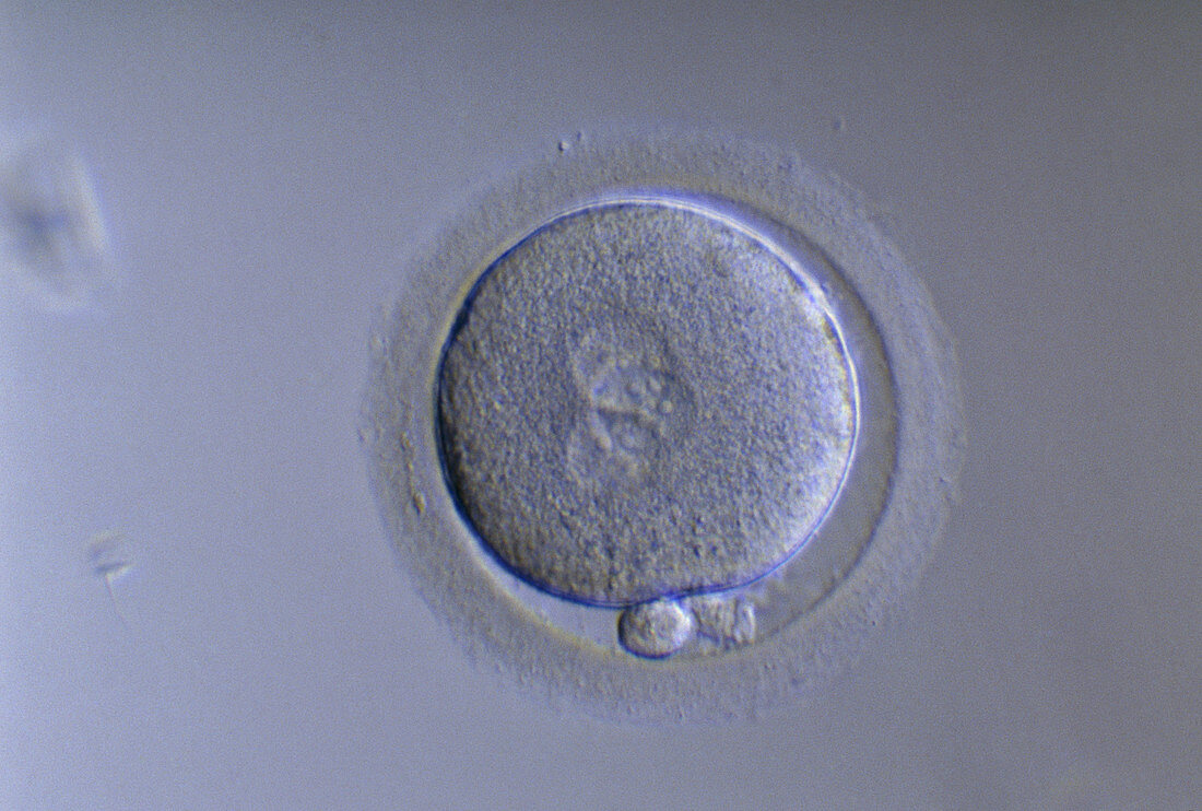 Polyspermic egg