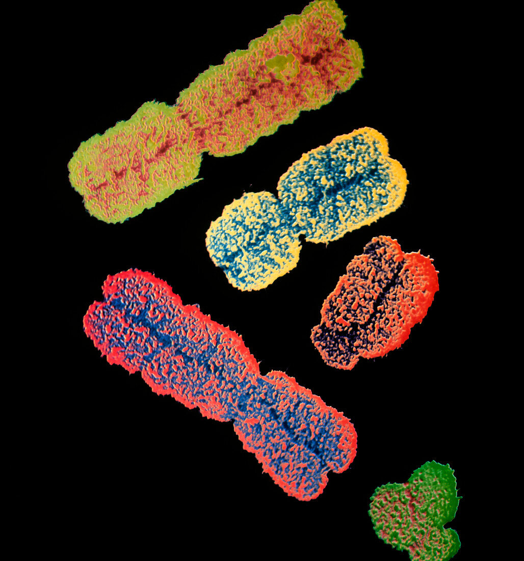 Coloured SEM of a group of human chromosomes