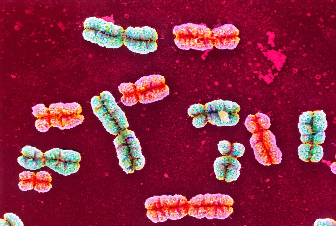 Coloured SEM of a group of human chromosomes
