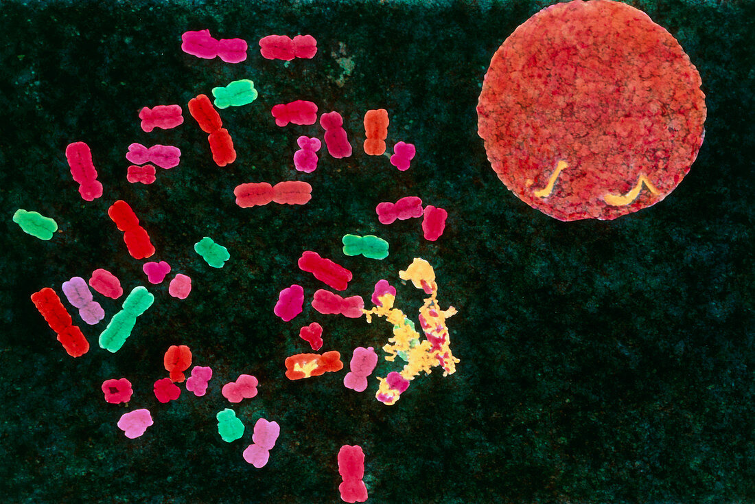 Coloured SEM of 46 human chromosomes and nucleus
