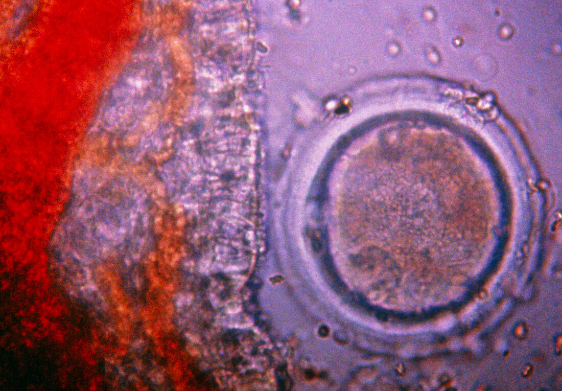 LM of a human ovum in the fallopian tube