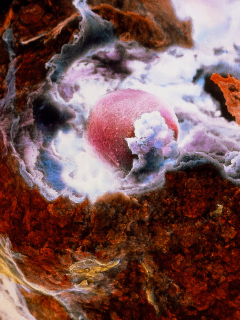 False-colour SEM of an egg at ovulation
