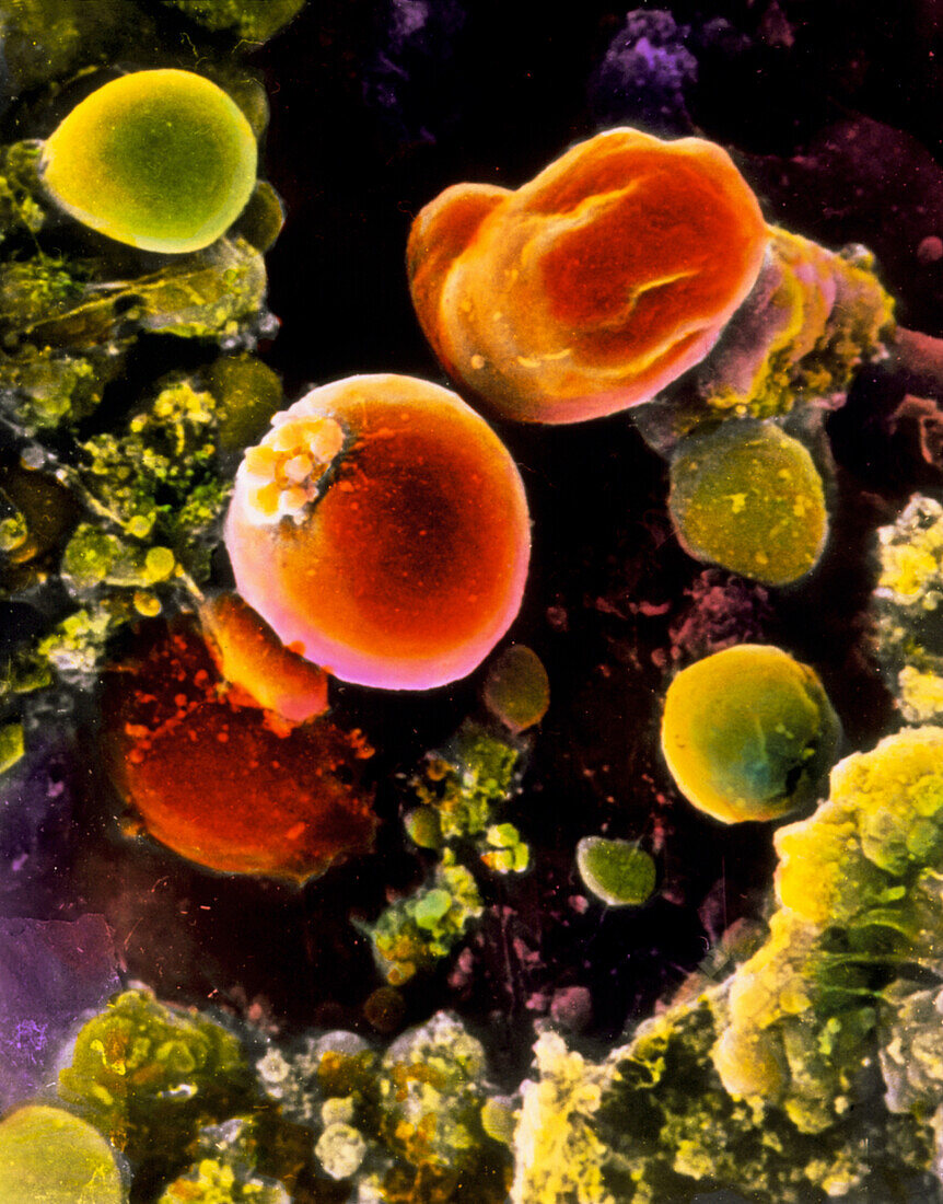Coloured SEM of primordial germ cells