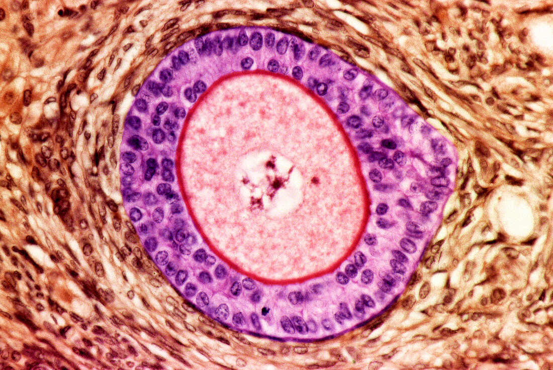 Ovarian follicle,light micrograph