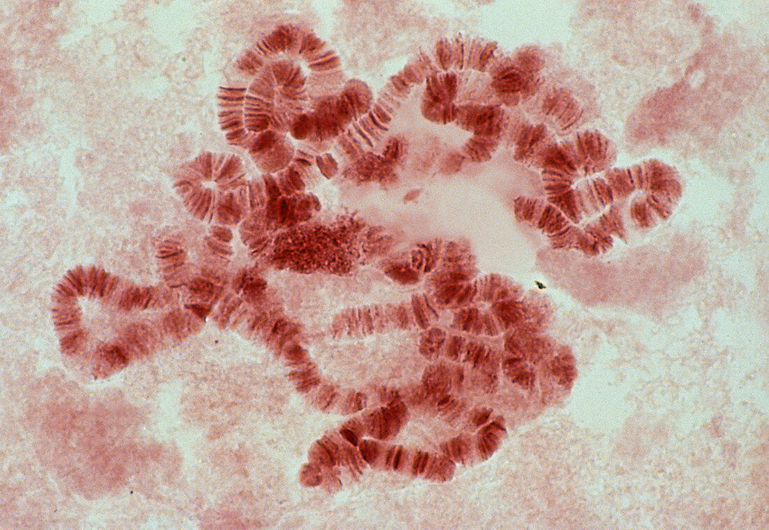 LM of giant polytene chromosomes,Drosophila